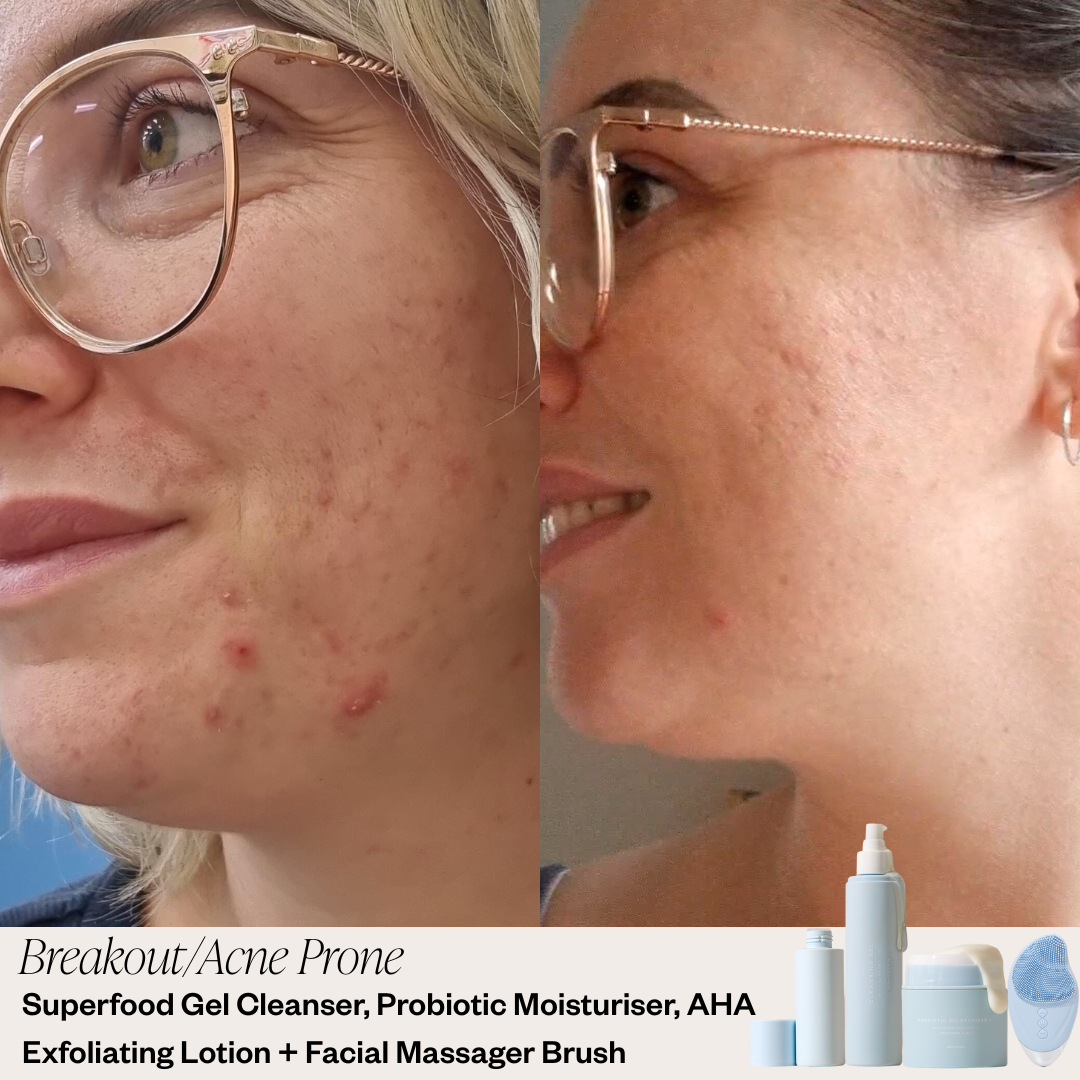 Beginner Skincare System- Oily/Combination