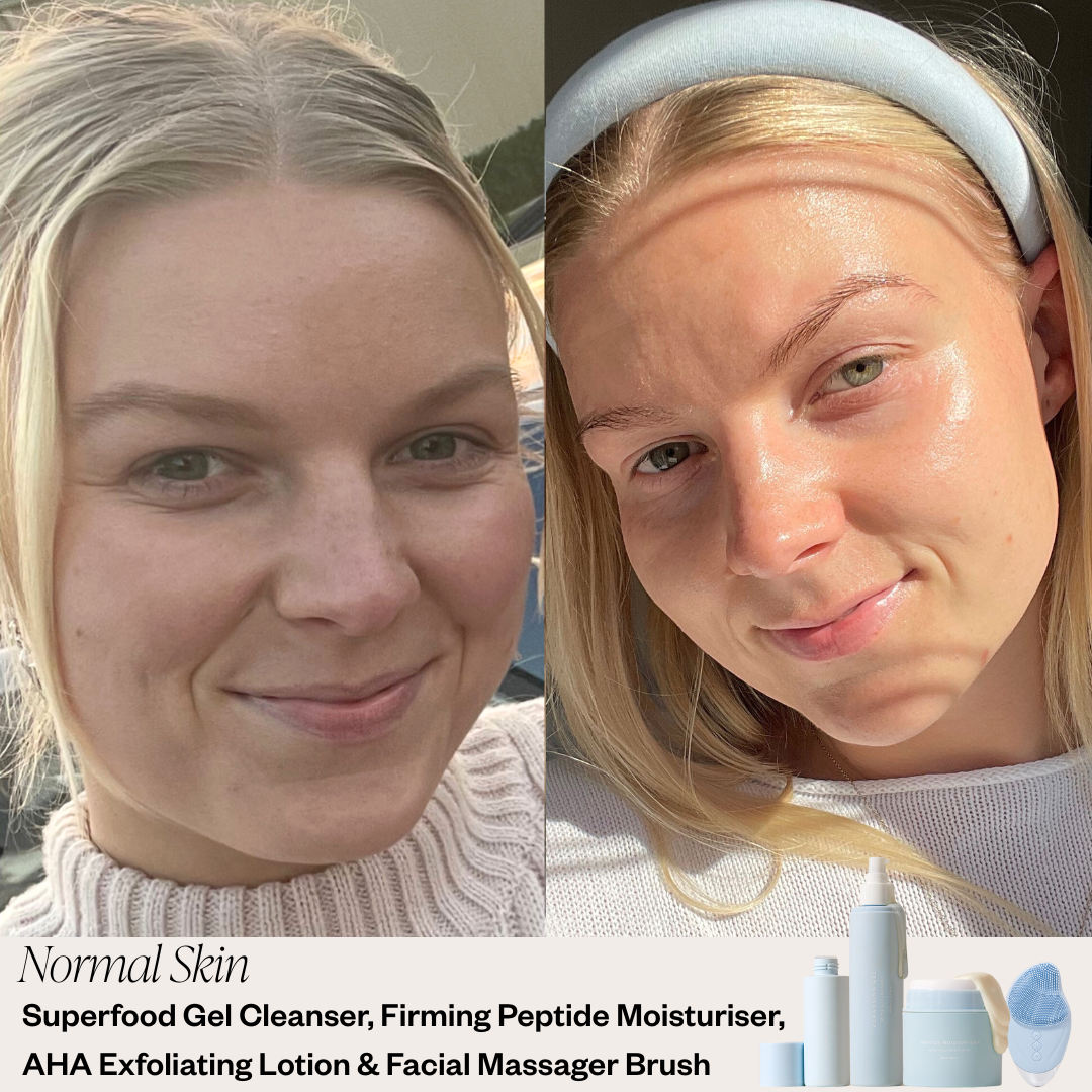 Beginner Skincare System- Normal