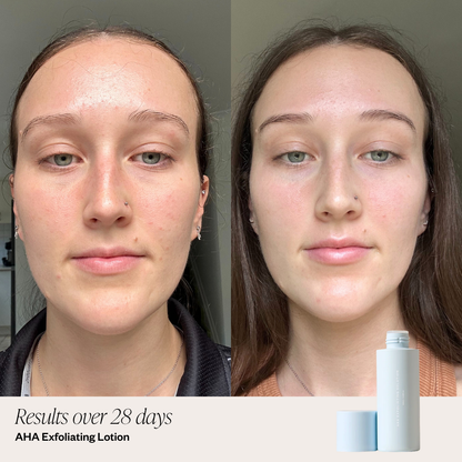 4 Step Firming System