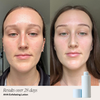 4 Step Brightening System