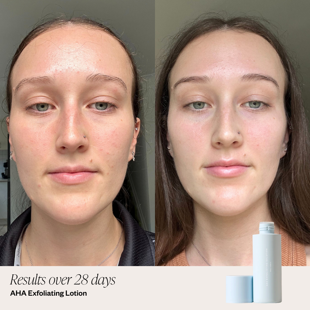 5 Step Hydration System