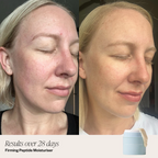 4 Step Hydration System