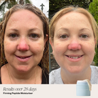 2 Step Brightening System