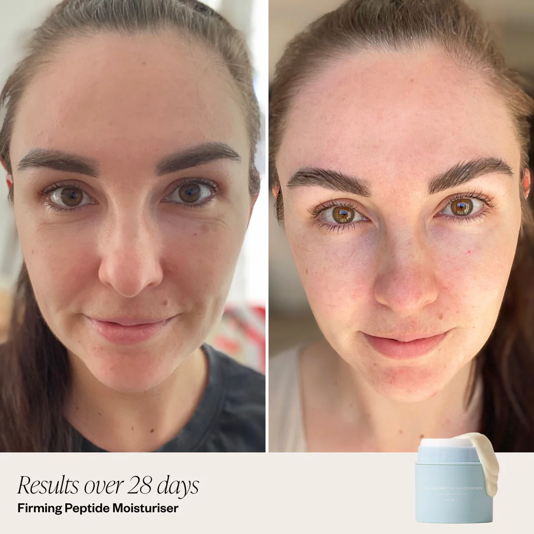 5 Step Brightening System
