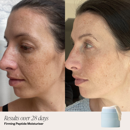 2 Step Brightening System