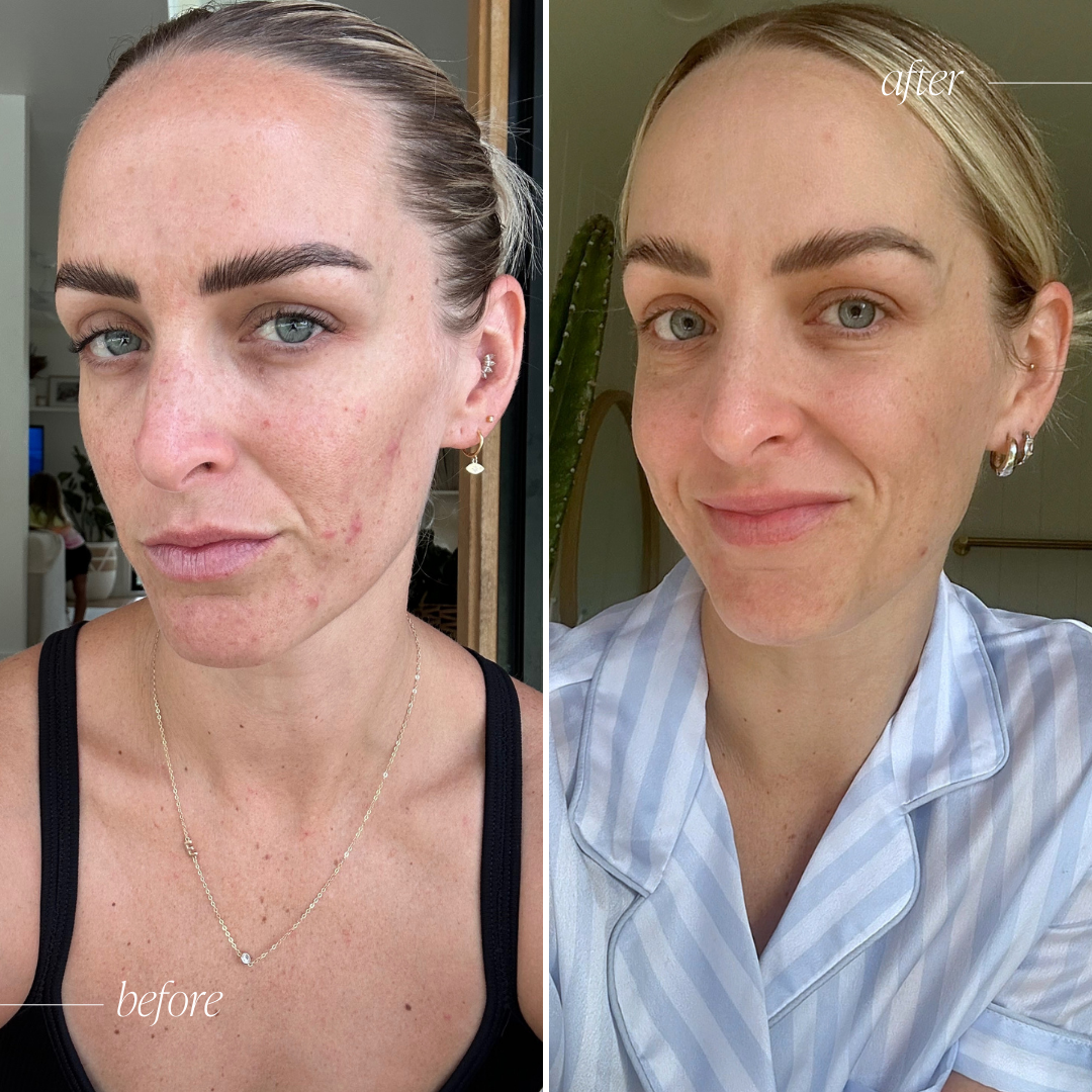 Vitamin B Serum Complex