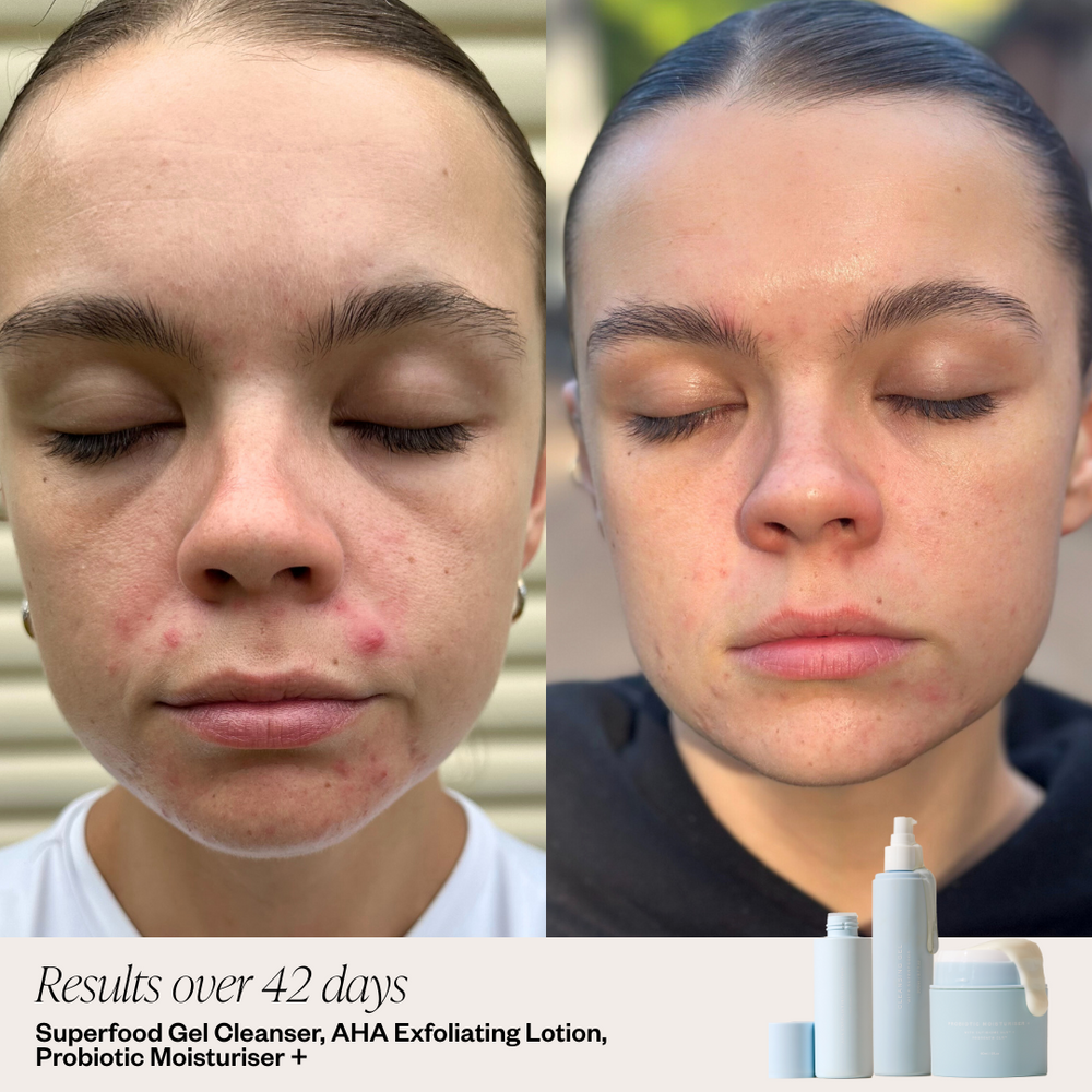 Original Formula - Probiotic Moisturiser +