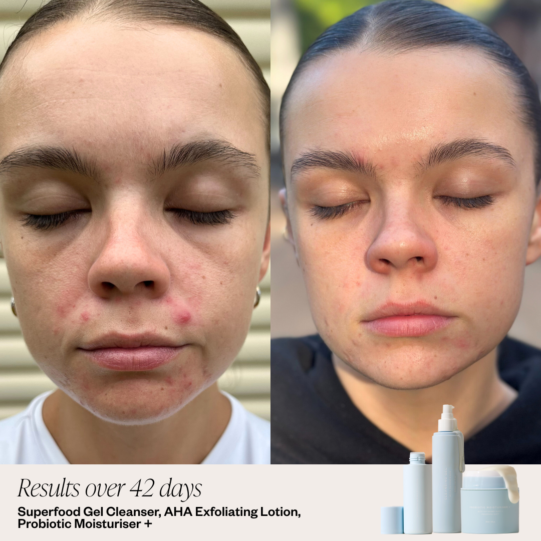 Original Formula - Probiotic Moisturiser +