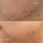Probiotic Moisturiser +