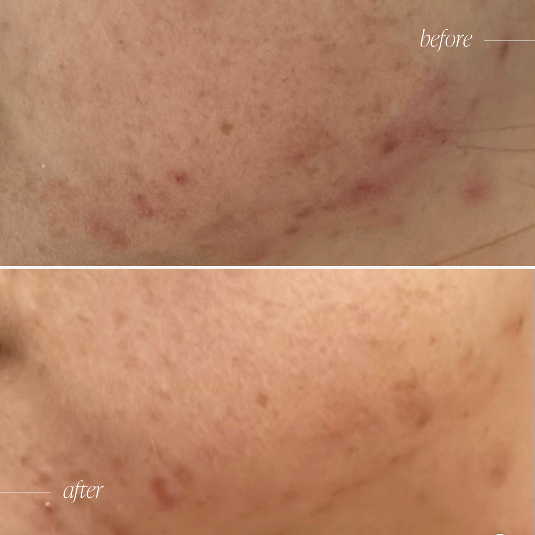 Probiotic Moisturiser +