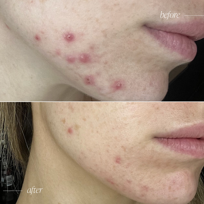 Probiotic Moisturiser + Trial Size