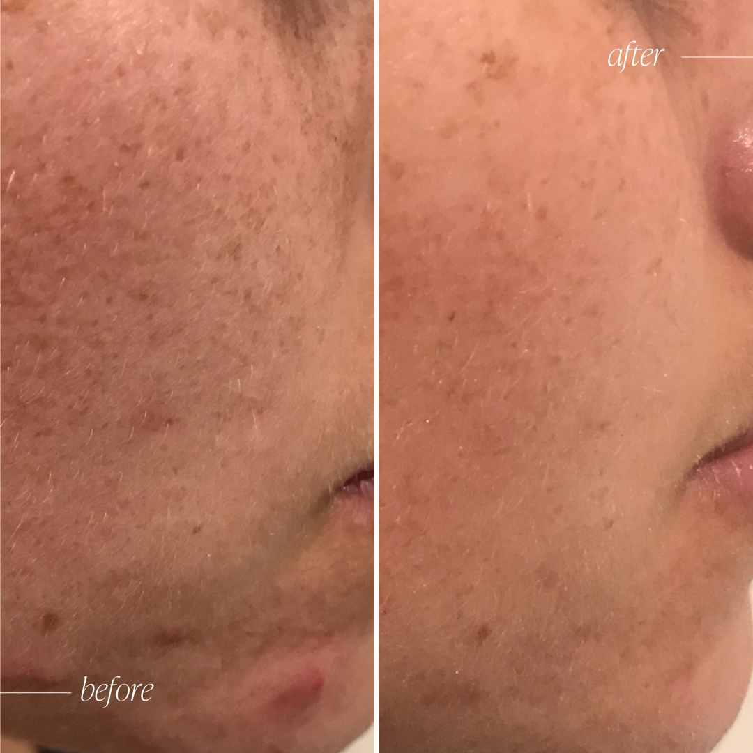 Vitamin C Brightening Serum - Trial Size