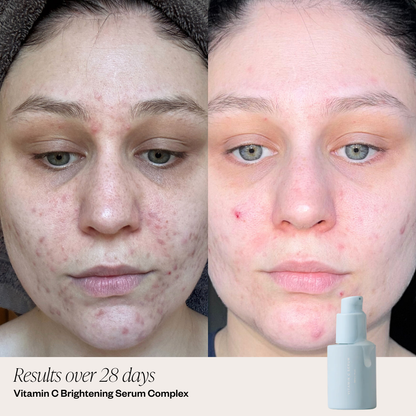 2 Step Brightening Serum System
