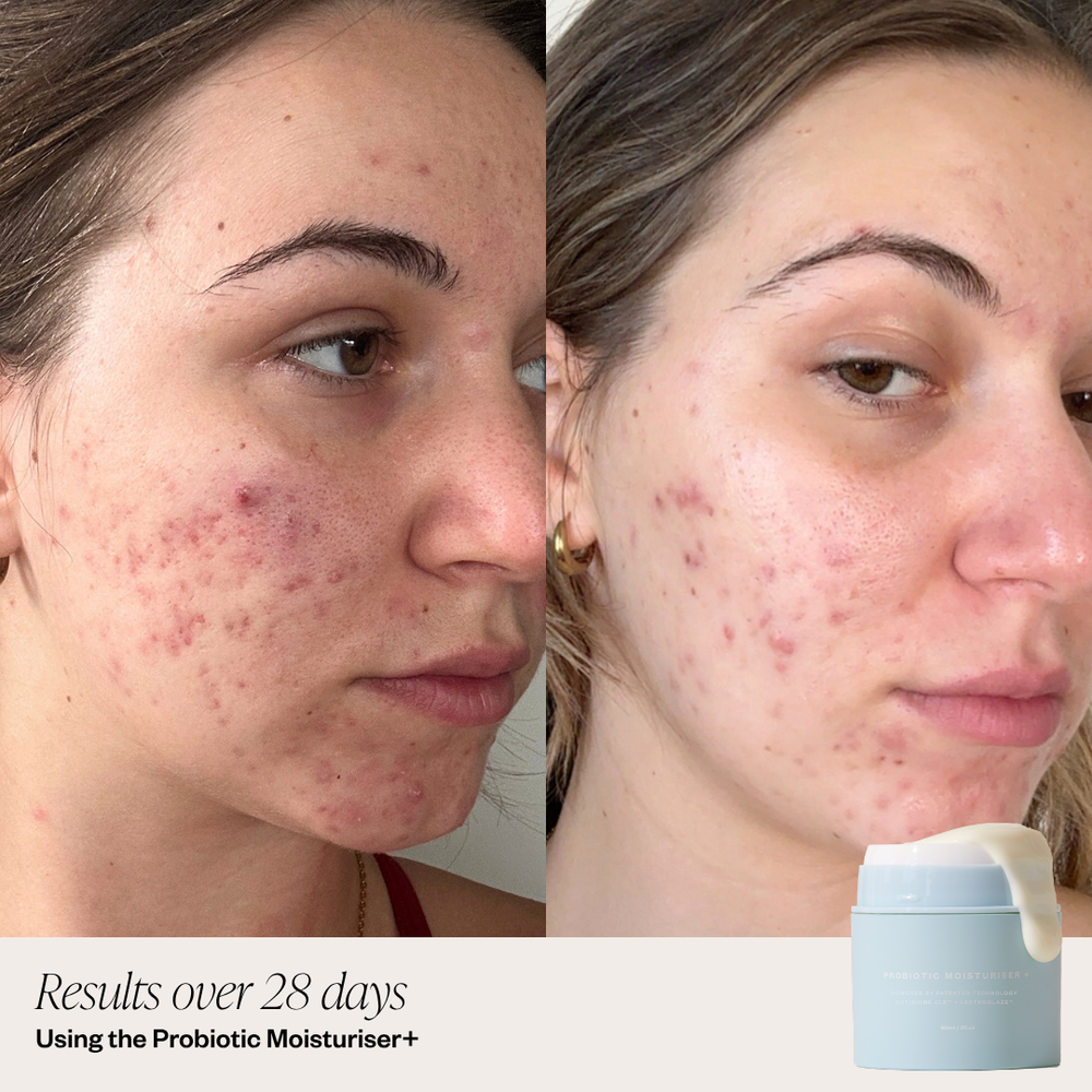 Probiotic Moisturiser + DUO
