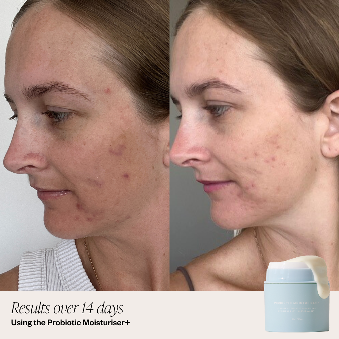 Probiotic Moisturiser +
